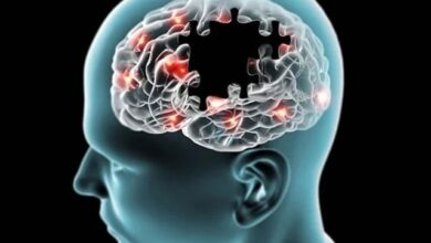 الزائمرز کی تشخیص کے لیے آسان و سادہ طریقہ کار وضع