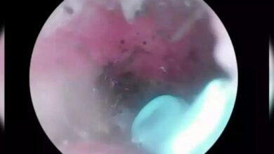 کان کے درد میں مبتلا خاتون کے متعلق ڈاکٹروں کاہولناک انکشاف