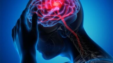 2050 تک فالج سے اموات میں 50 فی صد تک اضافہ متوقع