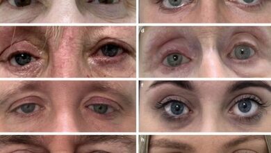 مصنوعی آنکھیں بنانے کا آسان اور تیز تھری ڈی پرنٹنگ کا طریقہ کار وضع