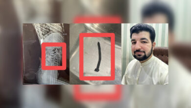 ڈاکٹر نے 8 سالہ بچی کی آنت سے کیل نکال کر بڑی سرجری سے بچالیا